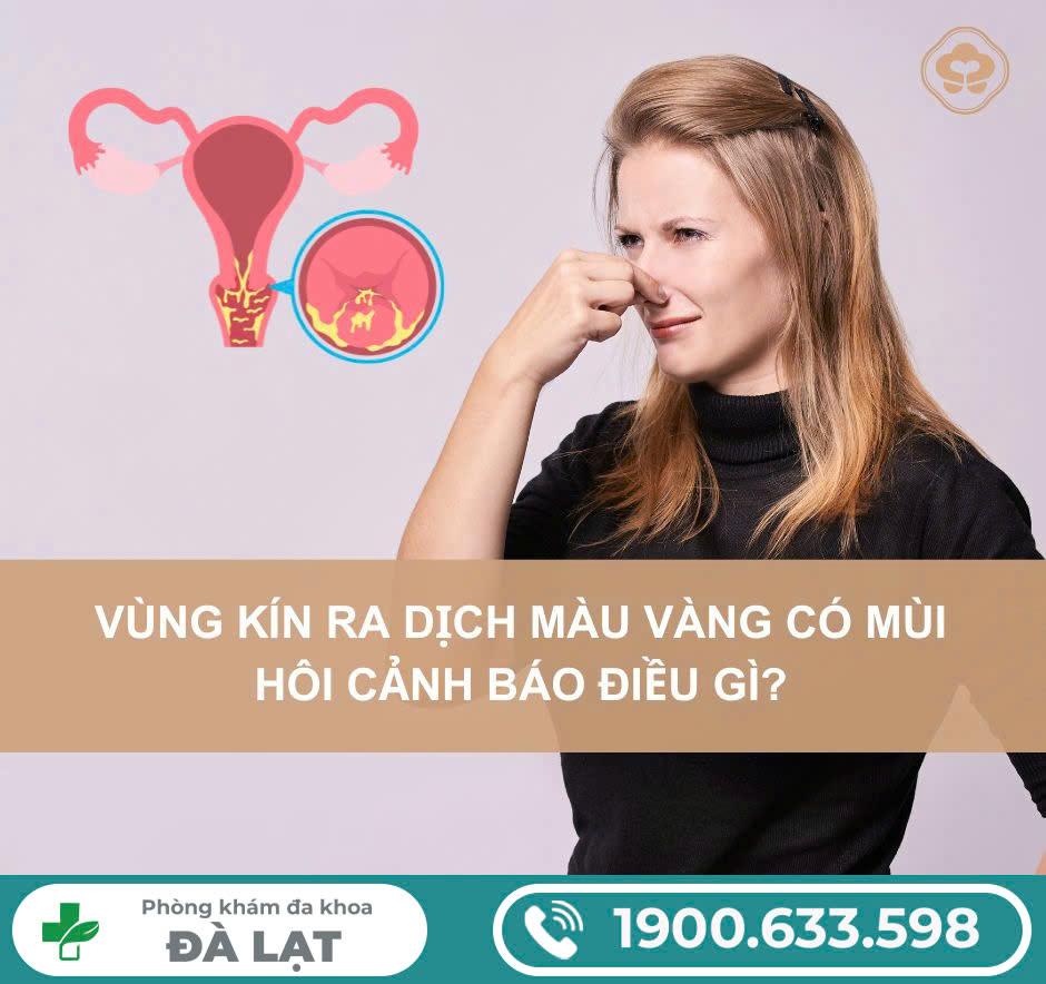 Hình ảnh minh họa